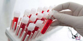 تحليل الفيتامينات