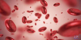 أنيميا نقص الحديد Iron-deficiency Anemia