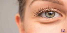 انتفاخات تحت العين Bags under eyes