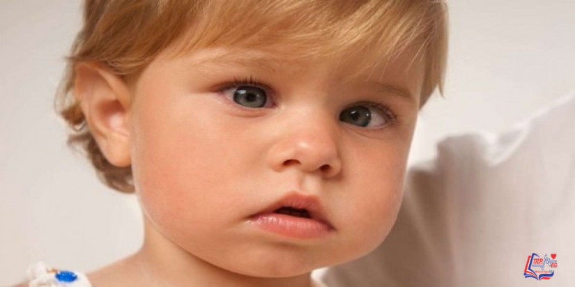 ما هو الحول المتقطع عند الاطفال ؟