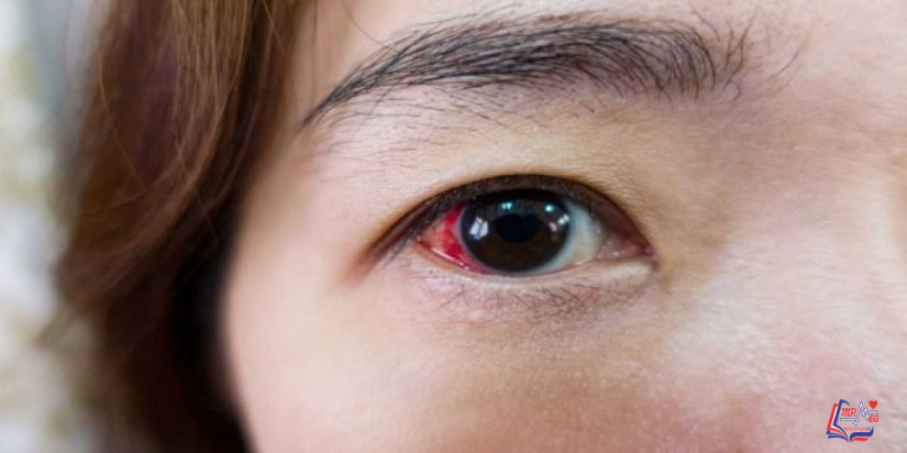 هل يعود النظر بعد عملية انفصال الشبكية ؟ .. اكتشف الإجابة