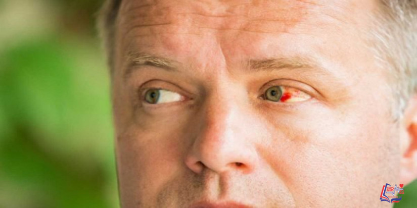 اكتشف كيف يمكن علاج نزيف الشبكية عند مرضى السكري