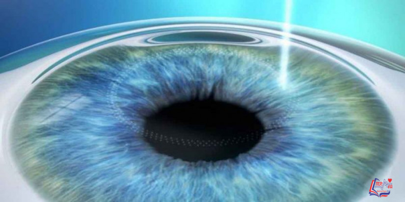 فيمتو سمايل لتصحيح عيوب الإبصار .. المميزات والعيوب