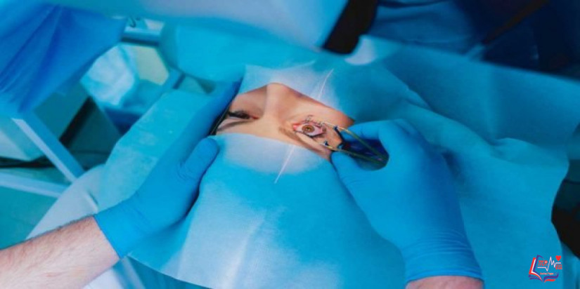 علاج الجلوكوما بالليزر وأنواع الليزر المستخدمة في علاج الجلوكوما