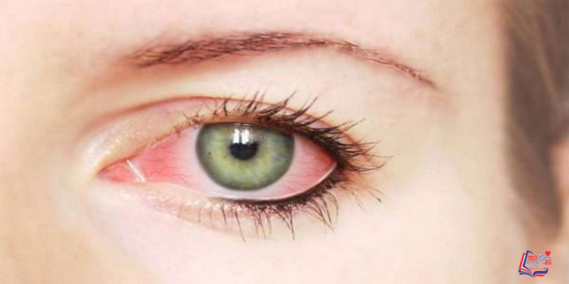 اسباب نزيف العين .. و مضاعفاته و طرق العلاج