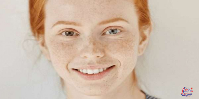 عوامل تباين لون قزحية العين