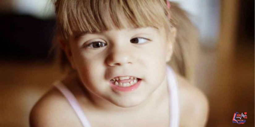 علاج الحول بطرق مختلفة مع التمارين.. ومتى يجب اللجوء للجراحة؟