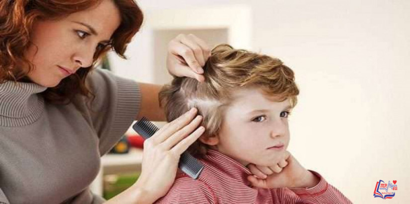 هل يمكن علاج القمل بالخل ؟ وتحذيرات هامة عند استخدامه