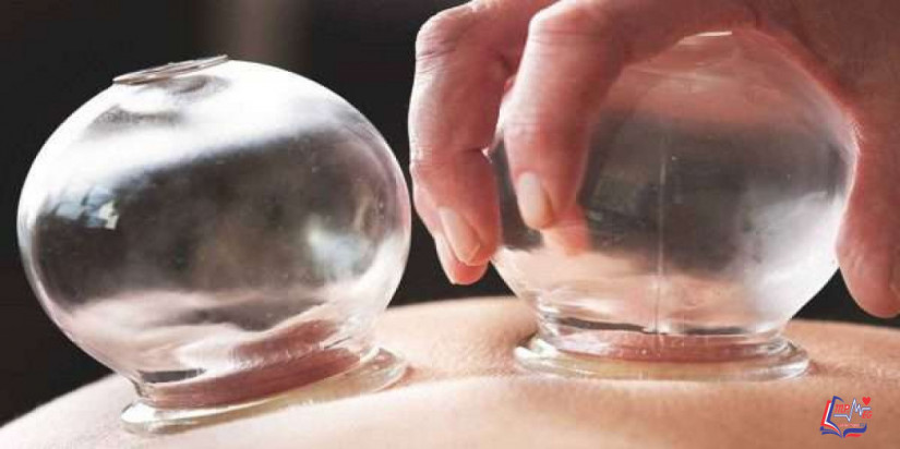 فوائد الحجامة للنساء والرجال .. هل هي حقيقية؟