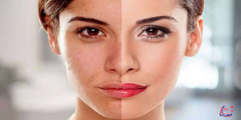 كيفية تبييض الوجه بعناصر طبيعية وعلاجات منزلية موجودة في مطبخك