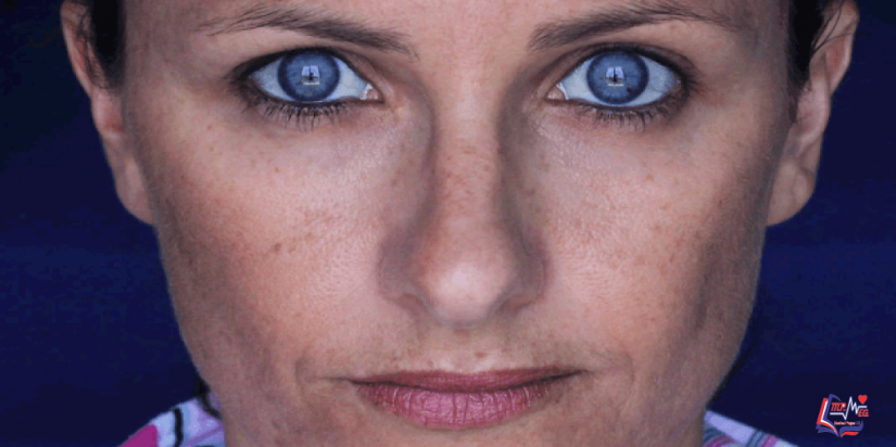 علاج الكلف العميق والسطحي.. والآثار الجانبية لعلاجات الكلف