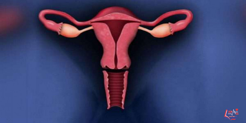 اعراض تضخم الرحم وأسبابه.. وكيف يمكن علاجه وتشخيصه؟