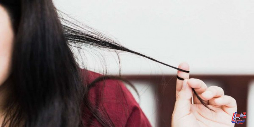 هوس نتف الشعر وعلاجه.. وهل هو مرض نفسي؟