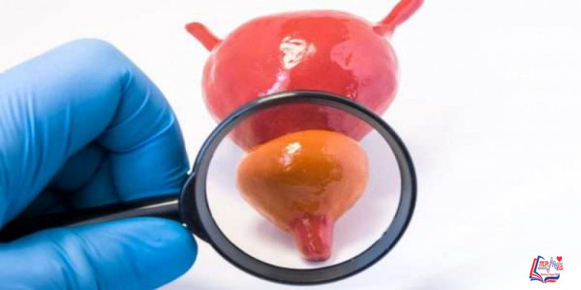 علاج احتقان البروستاتا بالأدوية والإجراءات الطبية والجراحة