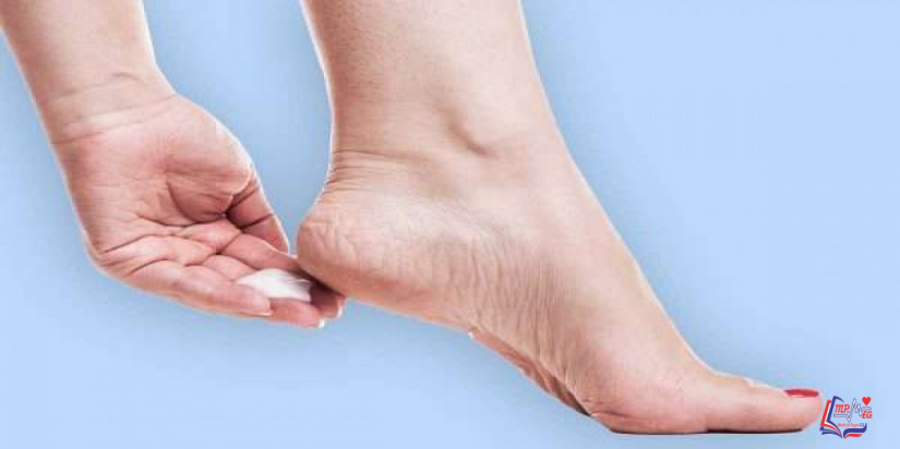 علاج تشققات القدم بالعلاجات المنزلية والطرق الطبية