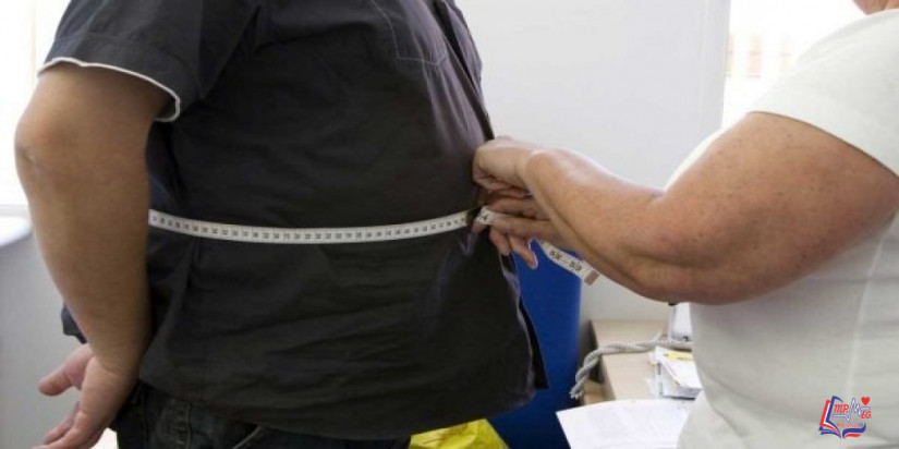 اسباب توسع المعده بعد التكميم .. وكيف يمكن الوقاية منه؟