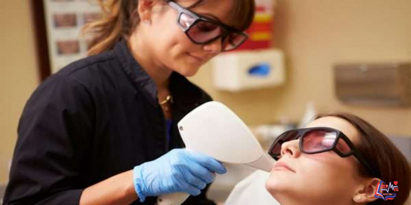 علاج الكلف بالليزر .. هل الليزر فعّال لعلاج الكلف؟