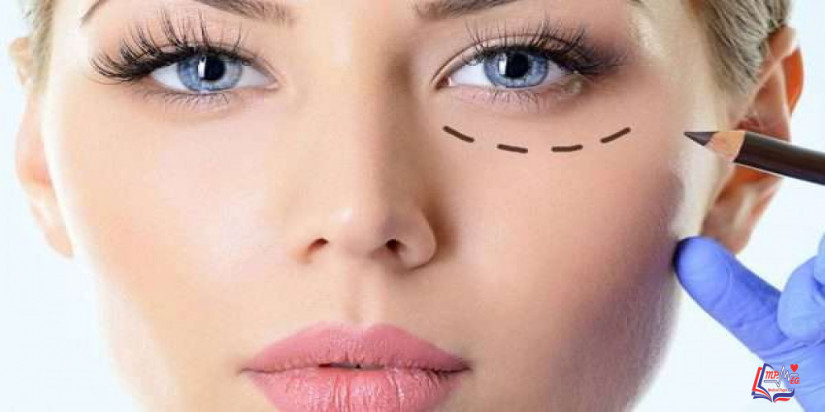 تكلفة عملية شد الجفون .. وما هي خطوات هذه العملية؟