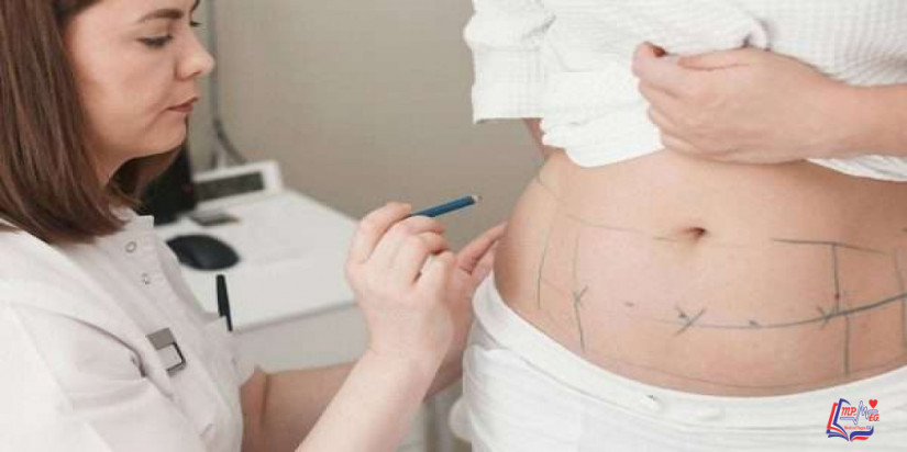 هل تعود الدهون بعد عملية الشفط ؟ تعرف على الإجابة