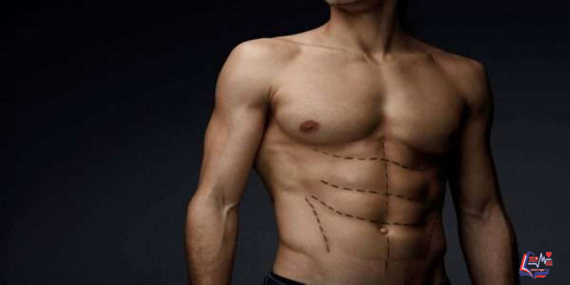 نحت الجسم بالفيزر ..طريقك للحصول على الجسم المثالي