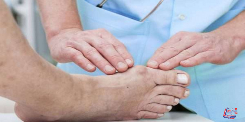 علاج بروز عظمة القدم بطرق بسيطة وبالجراحة التجميلية