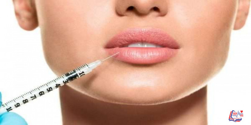 تكبير الشفايف بالفيلر .. ما نتائجه وتكلفته؟