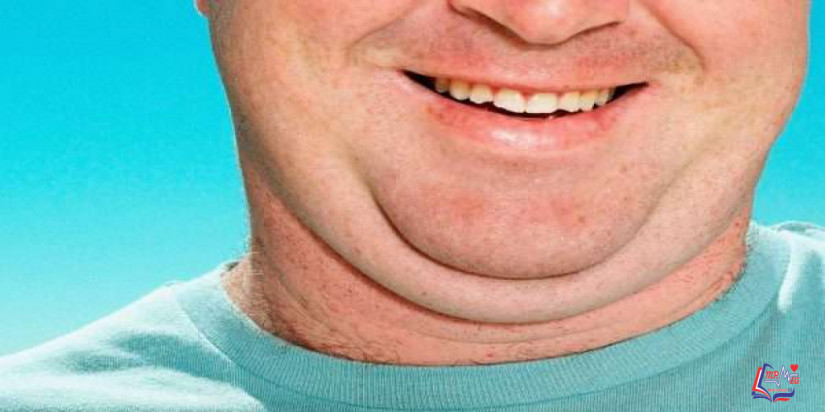 نحت الذقن للتخلص من الذقن المزدوج بطرق جراحية وغير جراحية