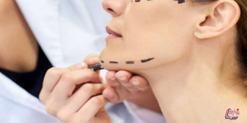 شد الوجه بالخيوط بدون جراحة ما هي مميزاته وعيوبه؟