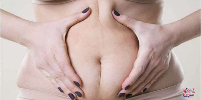 شد البطن بالليزر هل هو الأفضل؟ وما هي مميزاته وعيوبه؟