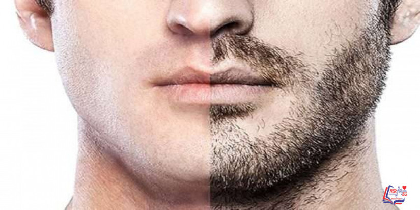 زراعة اللحية كيف تتم؟ ومن يمكنه إجرائها؟ وما تكلفتها؟