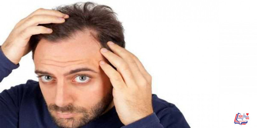 زراعة الشعر بالشريحة FUT وكيفية إجرائها وتكلفتها ومضاعفاتها