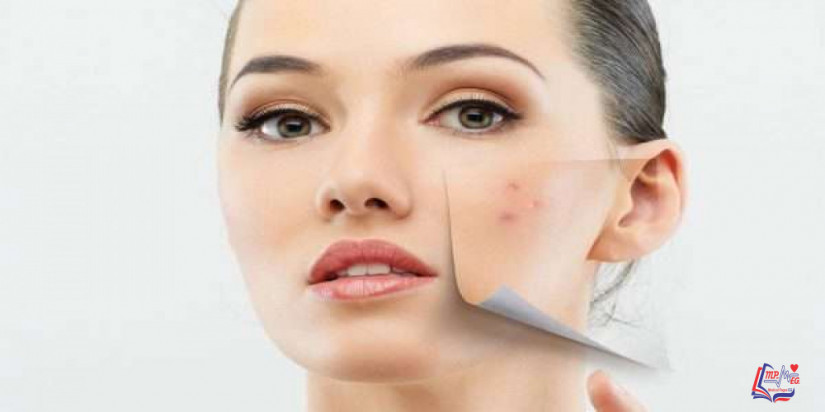 اماكن ظهور الحبوب في الوجه تخبرك عن صحتك!