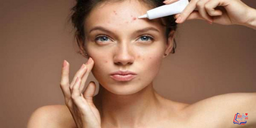 افضل علاج لحب الشباب وآثار حب الشباب