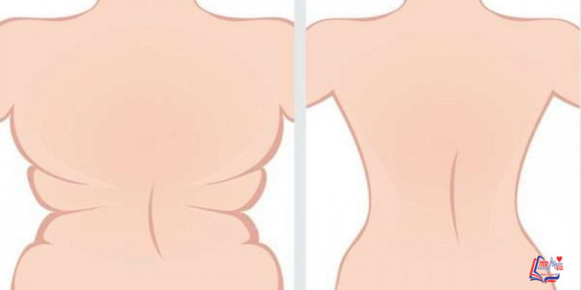 التخلص من دهون الظهر بالتمارين واليوجا بالصور والخطوات