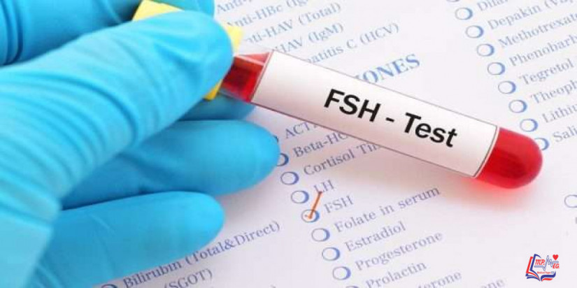 هل يمكن الحمل مع ارتفاع هرمون FSH