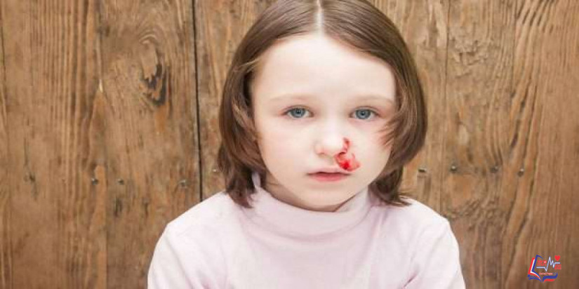 ما هي اسباب نزيف الانف المفاجئ عند الاطفال ؟