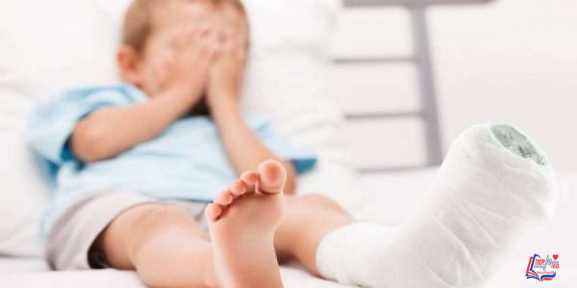 انواع الكسور عند الأطفال.. ودرجاتها وأسباب حدوثها