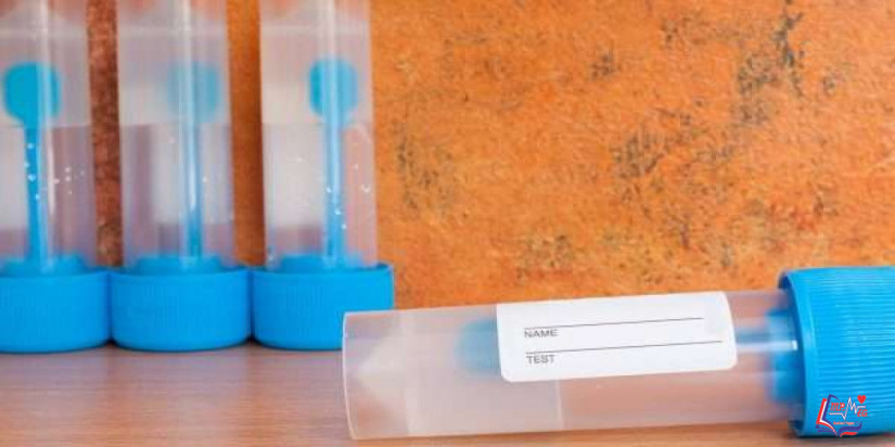 تحليل البراز للاطفال .. ما هي أهميته؟ ونصائح مهمة قبل التحليل