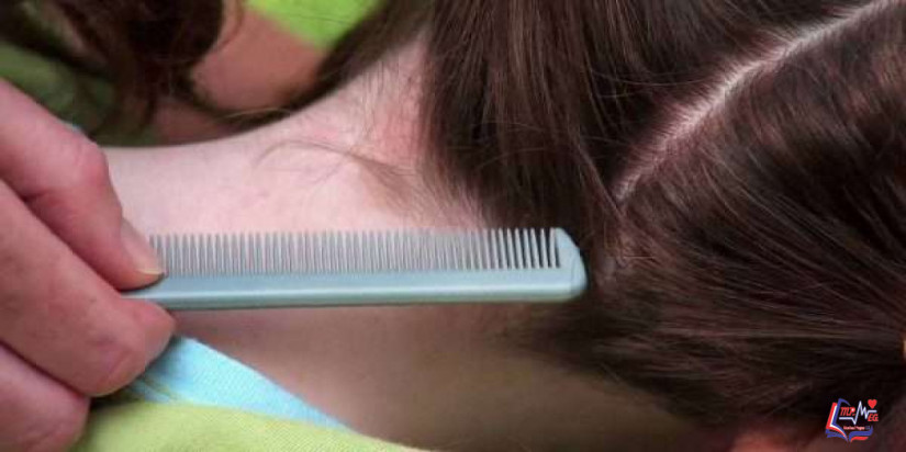 التينيا الجلدية عند الأطفال وأعراضها وطرق الوقاية منها