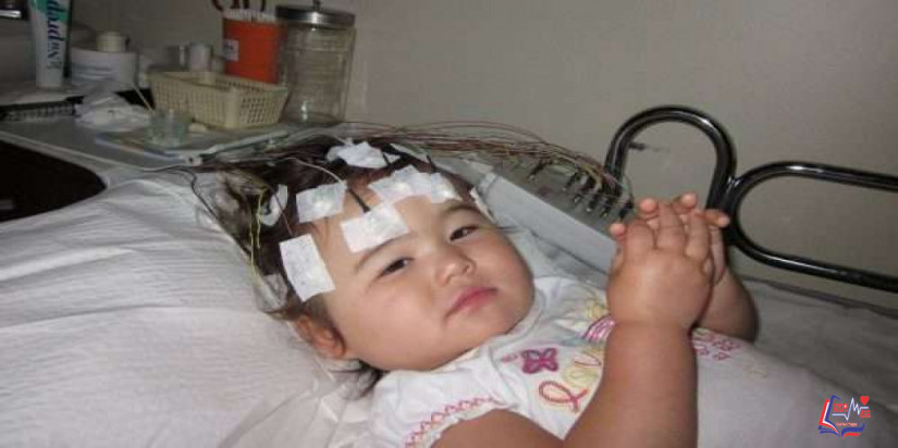 رسم المخ للاطفال .. ما أهميته؟ وكيف يتم؟ وهل له مخاطر؟