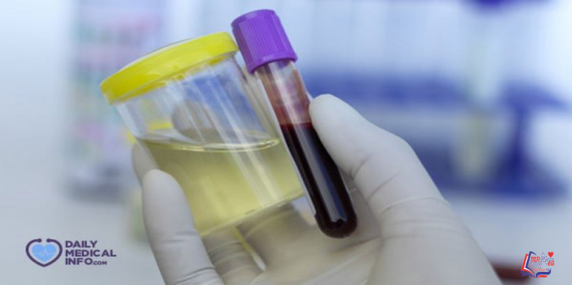 تحليل مرض السكر