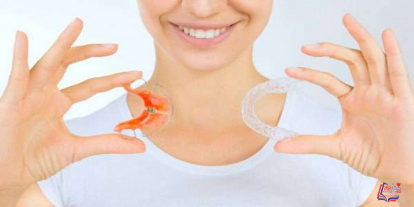 طريقة عمل تقويم الأسنان