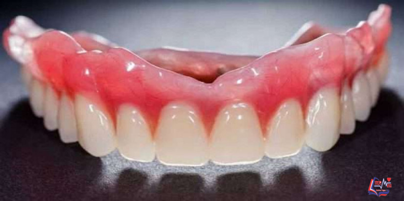 أضرار تركيبات الأسنان المتحركة