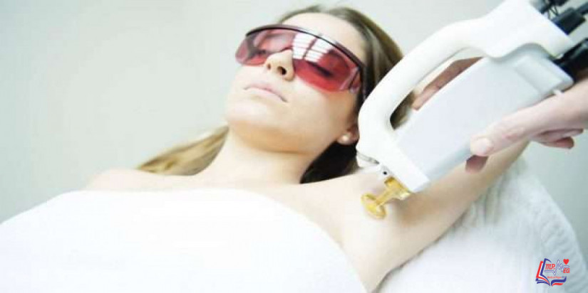 كيفية ازالة الشعر بالليزر و درجة استجابة الجسم له