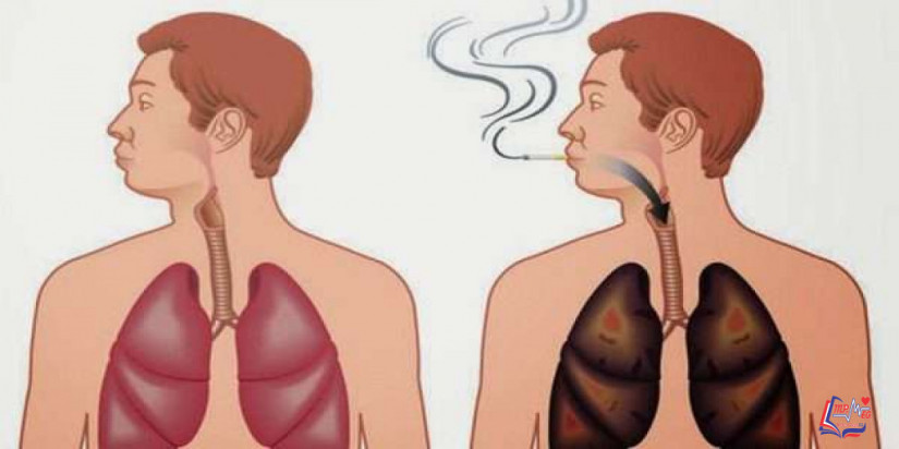 كيف أنظف الرئتين من اثار التدخين