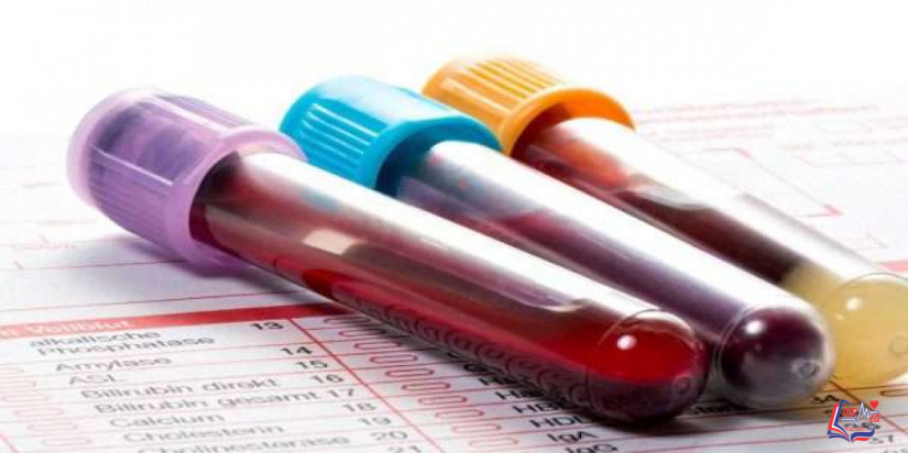 سبب نقص البلازما في الدم