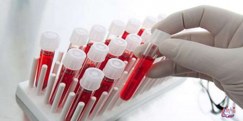 تحليل الفيتامينات