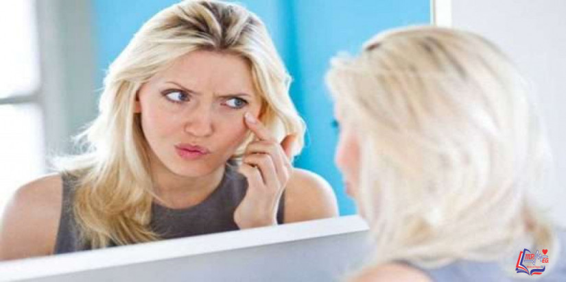 هل نقص فيتامين د يسبب حبوباً في الوجه