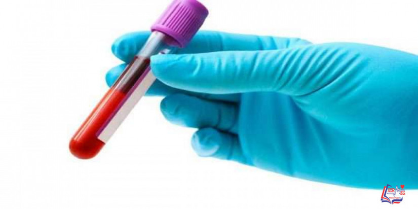 تحليل فيتامين ب