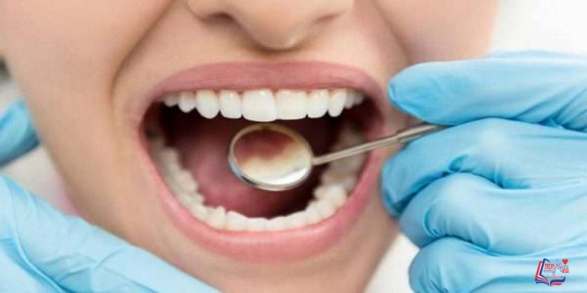 تسوس الأسنان Cavities